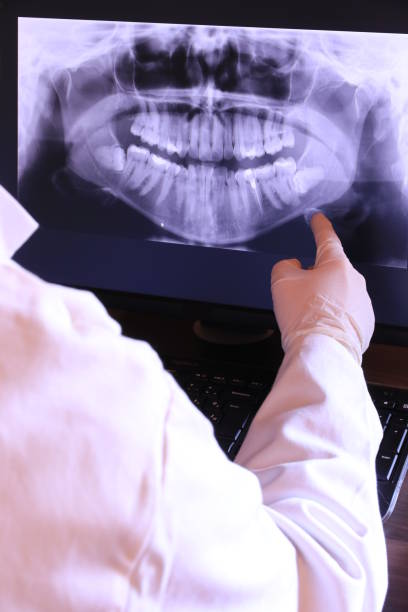 Best Emergency Dental Extractions in Chardon, OH