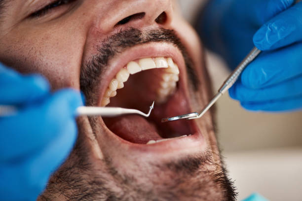 Best Broken or Cracked Tooth Emergency Dentist in Chardon, OH